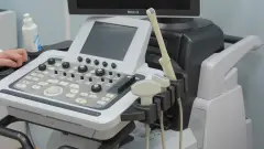 УЗД ультразвукова діагностика