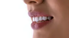 посмішка зуби