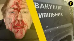 Денис Христов Голландець потрапив під обстріл